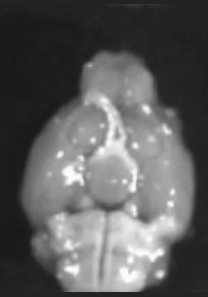 Fluorescence image of a mouse brain one hour after an injected dose of labelled tirzepatide